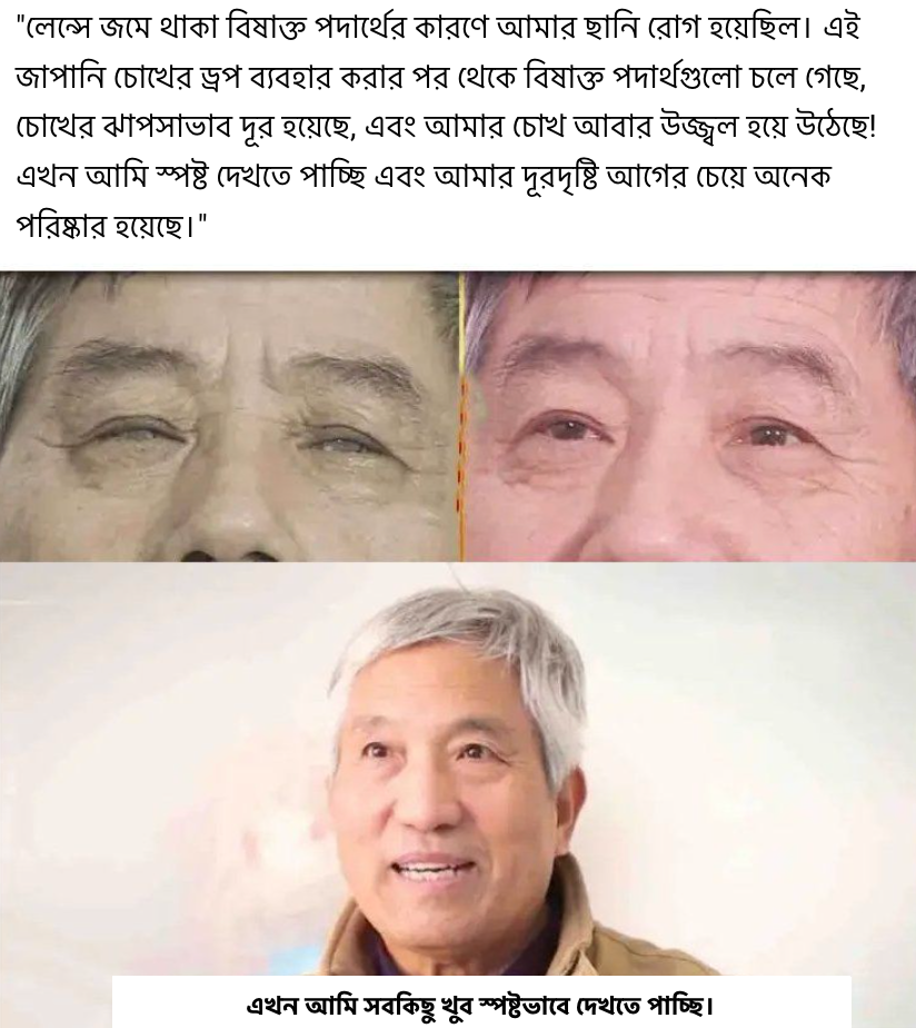 চোখের আগে পরে ২
